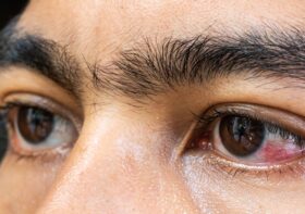 Retinal Diseases: Early Signs and Why You Should Act Fast