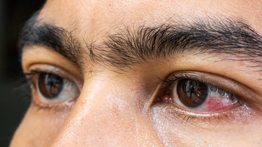 Retinal Diseases: Early Signs and Why You Should Act Fast